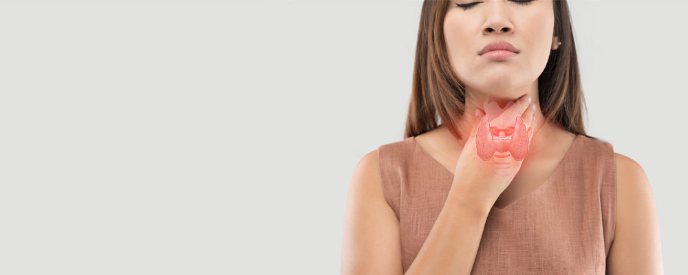 Thyroid artery embolization procedure illustration – RIVEA