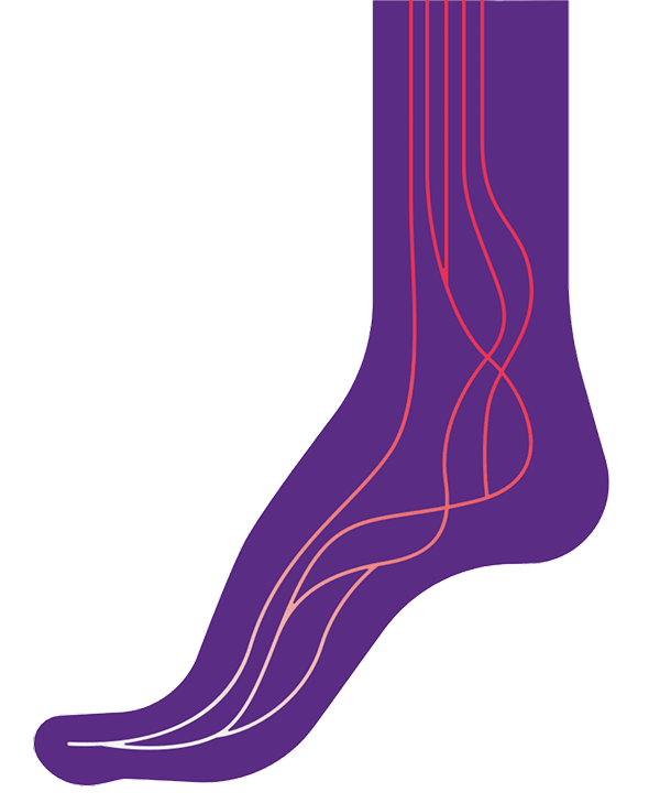 Peripheral artery disease treatment for foot – Rivea Vascular care image
