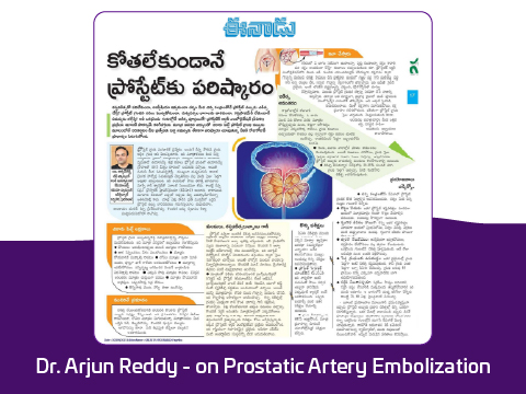 Rivea minimally invasive prostate embolization procedure