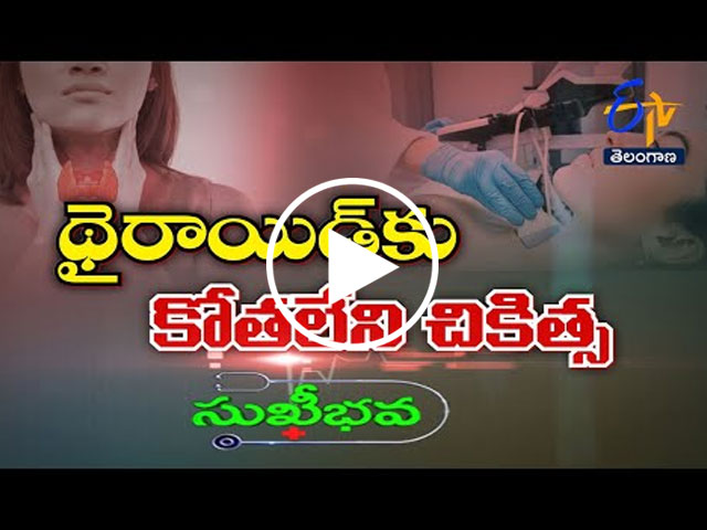 Thyroid nodule treatment using ultrasound-guided radiofrequency ablation